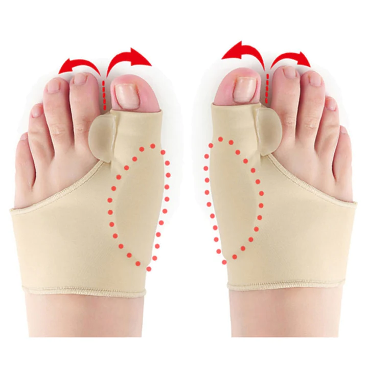 Gelový korektor Hallux Valgus – pohodlí a podpora