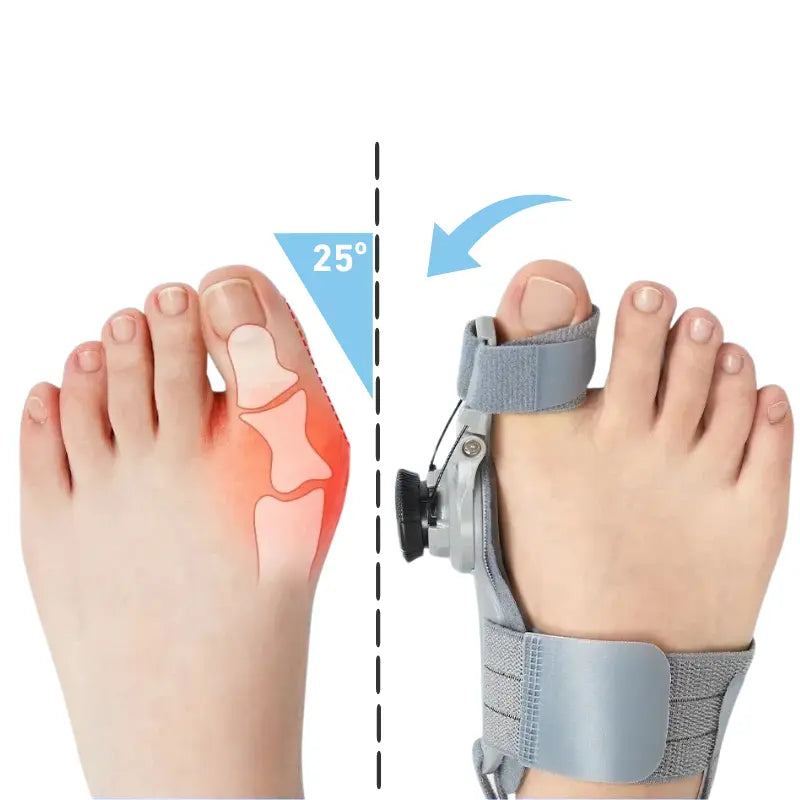 Korektivní bandáž na hallux